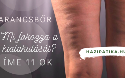 11 dolog, amely a növeli a narancsbőr kialakulásának esélyét