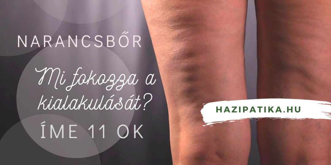 11 dolog, amely a növeli a narancsbőr kialakulásának esélyét