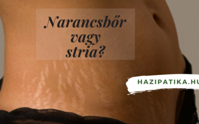 Narancsbőr vagy pedig stria? Mi a különbség?