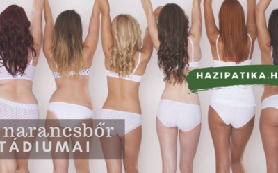 A narancsbőr típusai, stádiumai
