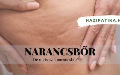 A nagy kérdés, mitől alakul ki a narancsbőr?