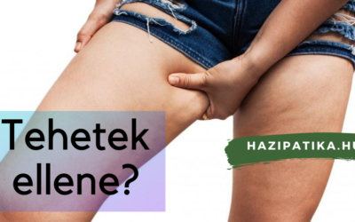 Narancsbőr? Hogyan kerüljük el?