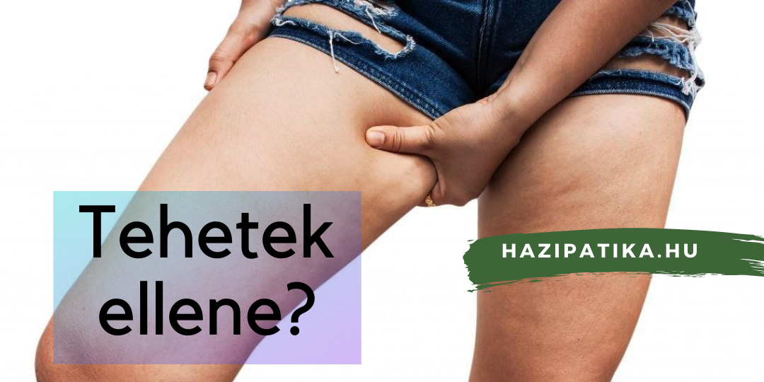 Narancsbőr? Hogyan kerüljük el?